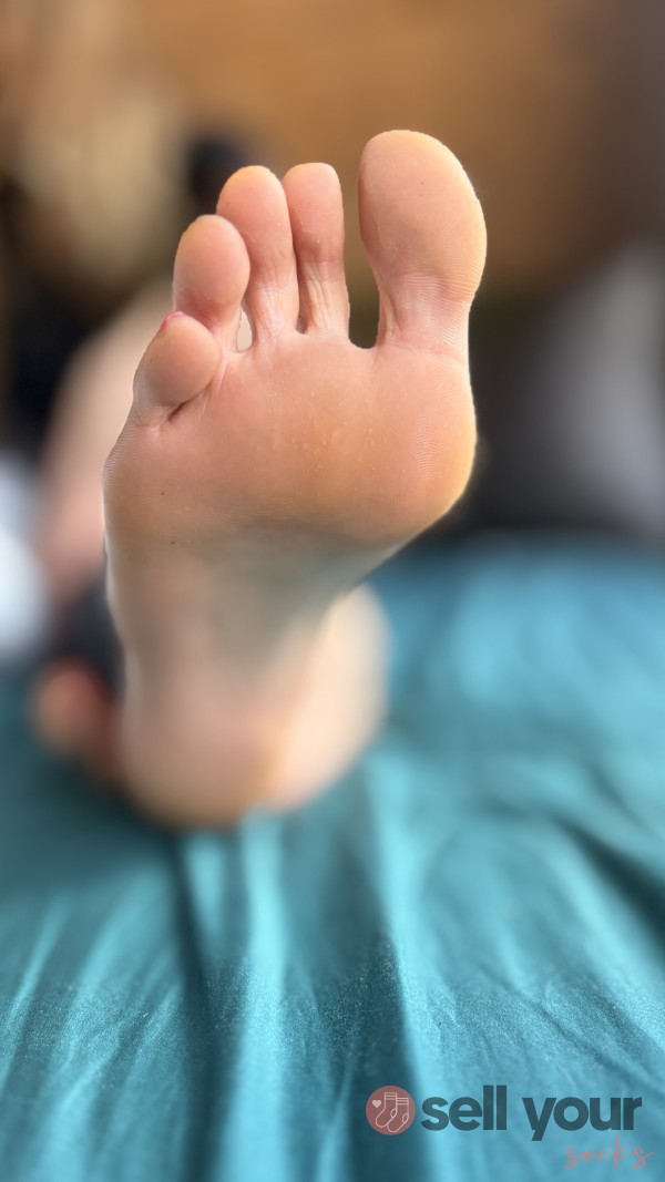 Sweaty Feet
