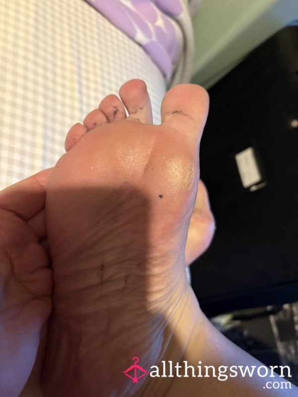 Sweaty Feet After A Long Hard Day At Work X