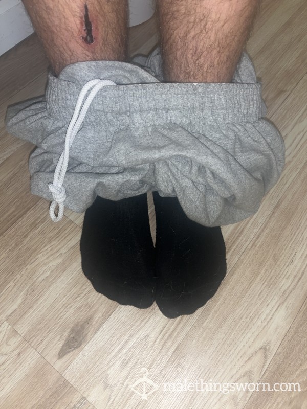 Sweaty Socks Vinegar Smell🤤