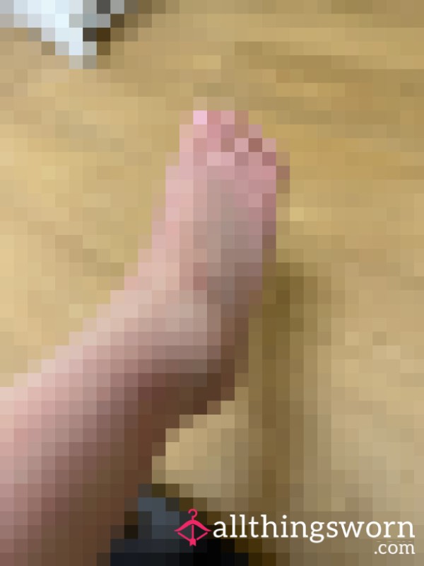 Swollen Ankle