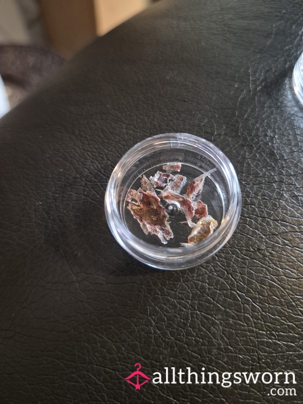 Tasty Little Pot Of My Scabs
