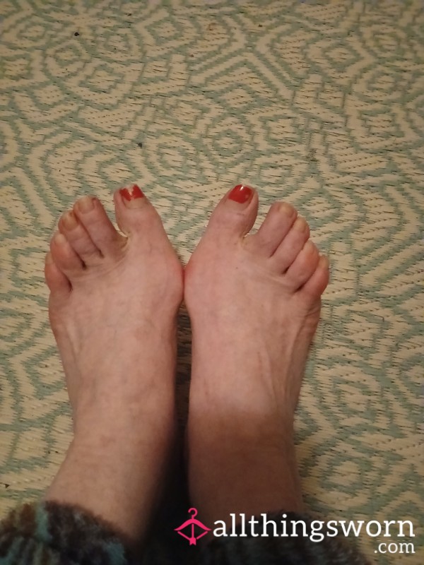 These Feet Need Some Attention