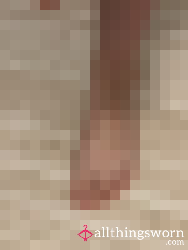 These Toes Need A Pedicure 🥴😷