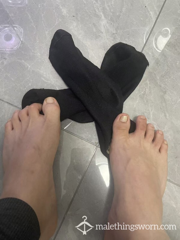 They Have Been Wearing Black Socks For Two Consecutive Days, And They Are Already Sore And About To Puff
