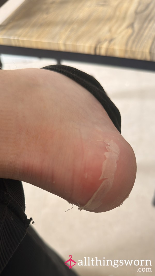 Today Took A Turn, A Gym Session Followed By A VERY Long Walk.. And My Feet Are In BITS 😭.. My Skin Is Literally P**ling Off! Every Foot Fetish Fiends Dream! 😘