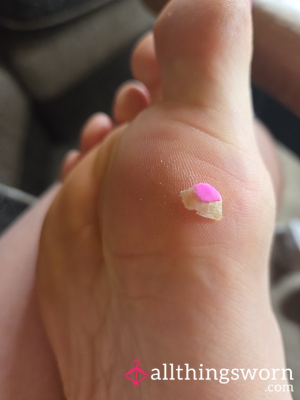Toe Nail