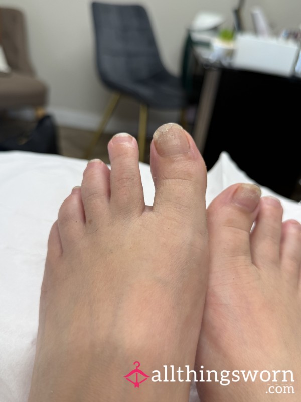 Toe Nail Clippings