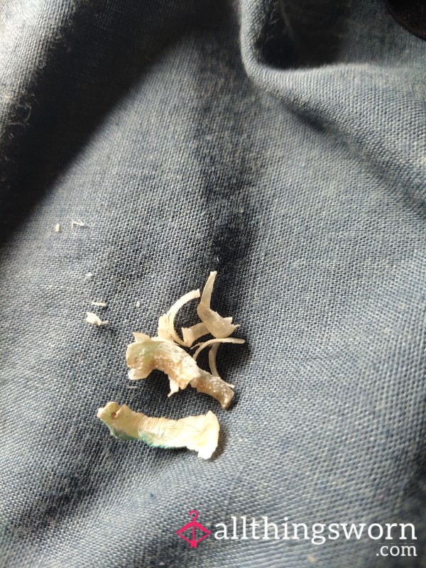 Toe Nail Clippings