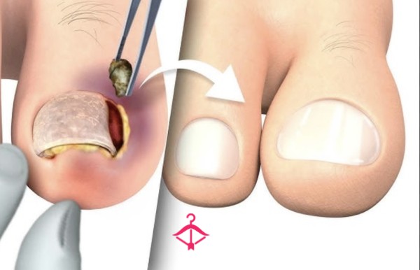 Toe Nail Lovers: RARE ONCE IN A LIFETIME ITEM