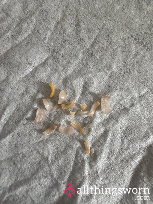 Toe Nails
