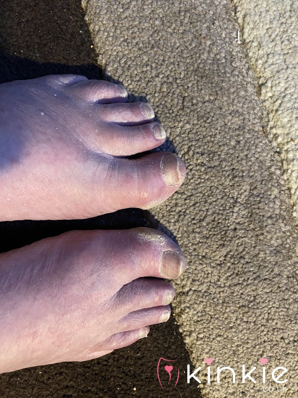 Toe Nails