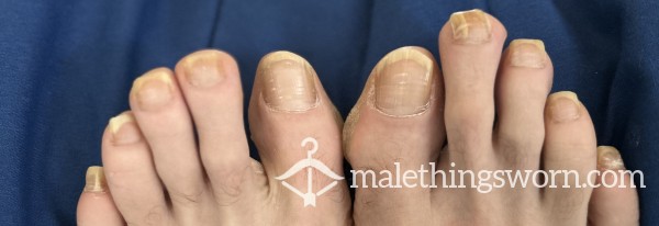 Toe Nails Or Finger Nails