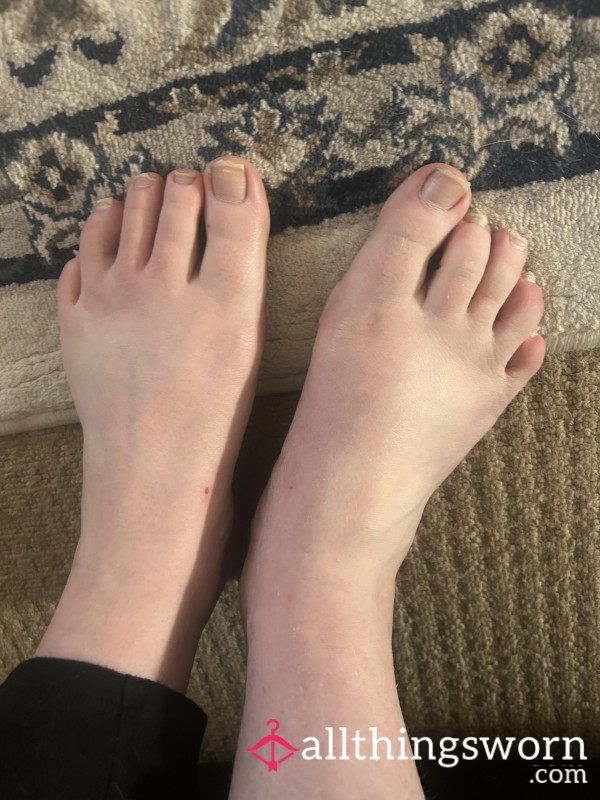 Toe Nails Ready To Be Clipped