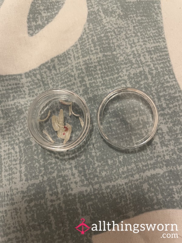 Toenail Clippings