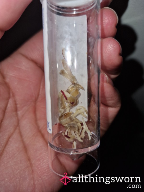 Toenail Clippings