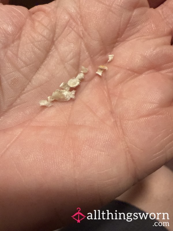 Toenail Clippings