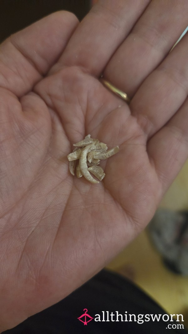 Toenail Clippings