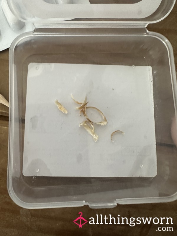 Toenail Clippings