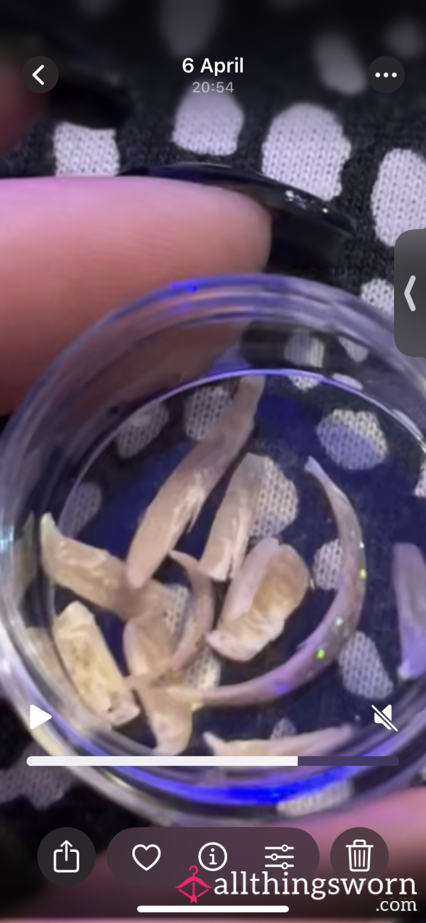 Toenails