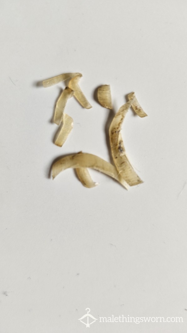 Toenails