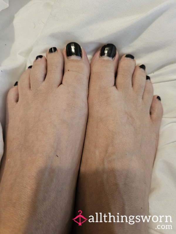 Toenails With Nail Polish, Can Send Before And After Pictures