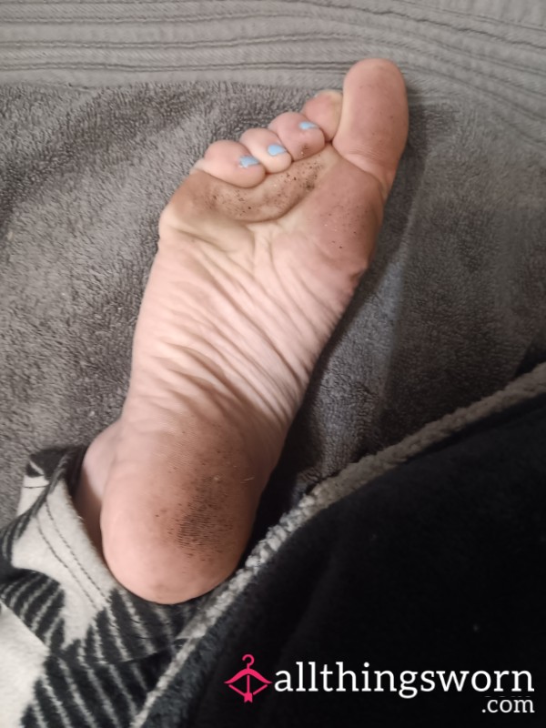 Toe/Sole Scrunch Photos