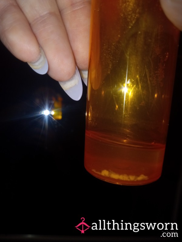 Tonsil Stones!! (Super Stinky)