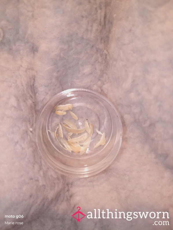 Tub Of Toe Nail Clippings