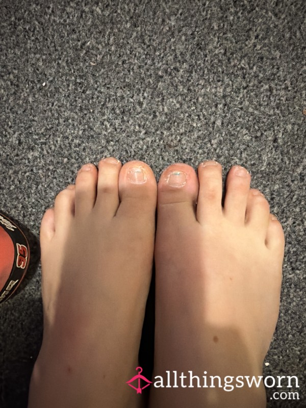 Ugly Feet