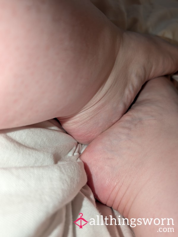 Ugly Nasty Feet Pics, No Pedicure, Calluses And Warts, Horrible Feet