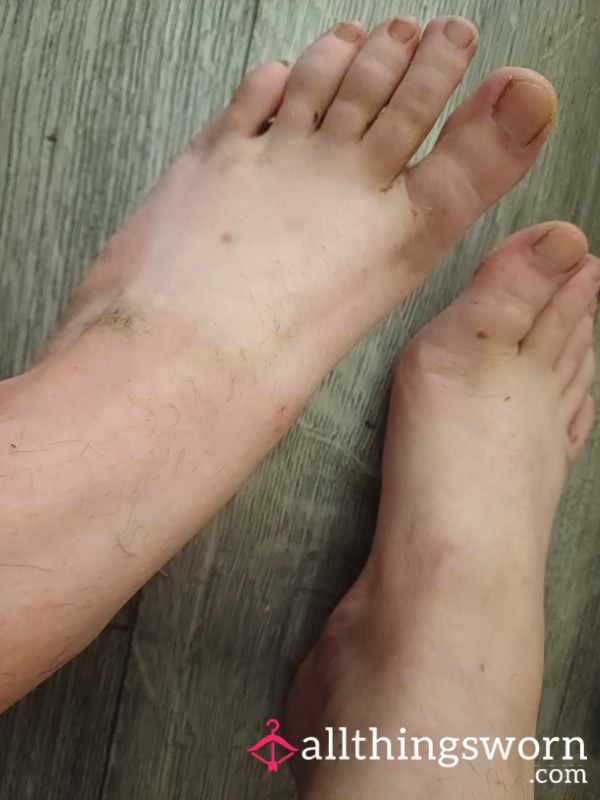 Unwashed, Dirty Feet