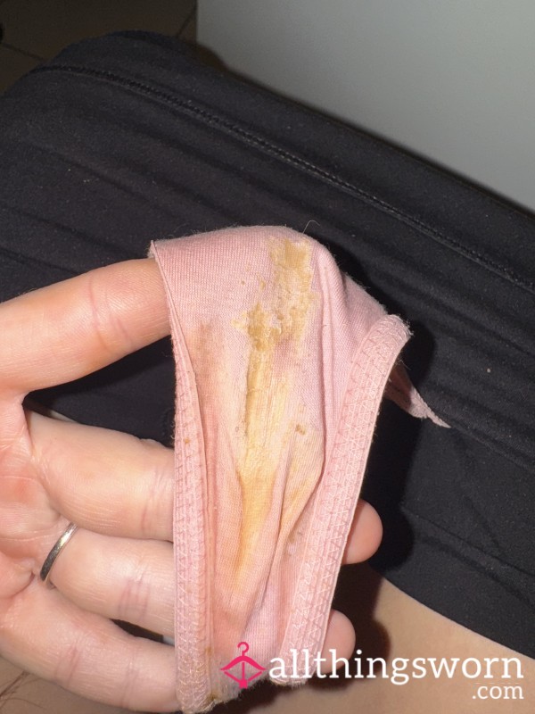 Very Worn Over 24 Hours