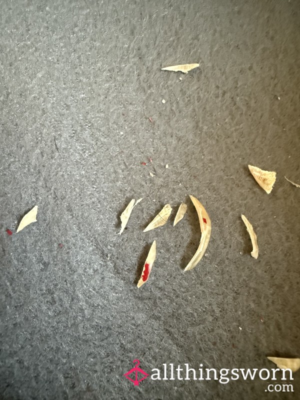 View My Recently Cut Toenails