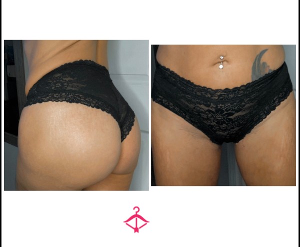 VS Black Lace Cheeky Panty