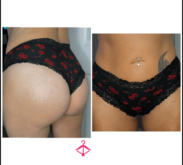 VS Cherry Print Cotton Cheeky Panties 🍒