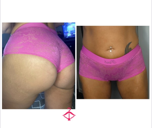 VS Hot Pink Lace Boyshorts