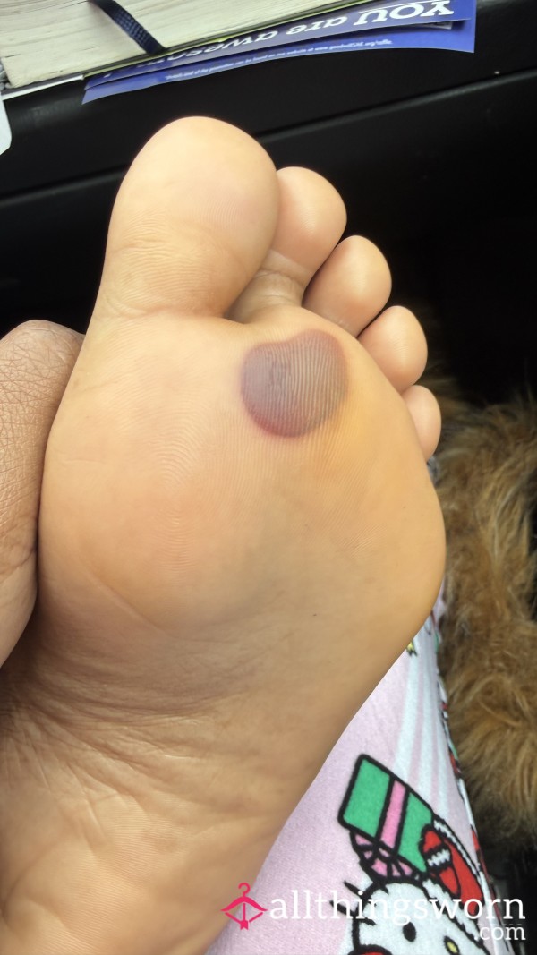 Wanna See Me Pop It?