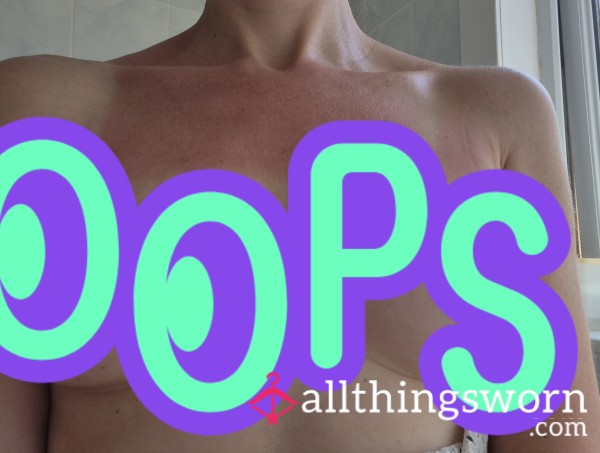 Wanna See My White Bits
