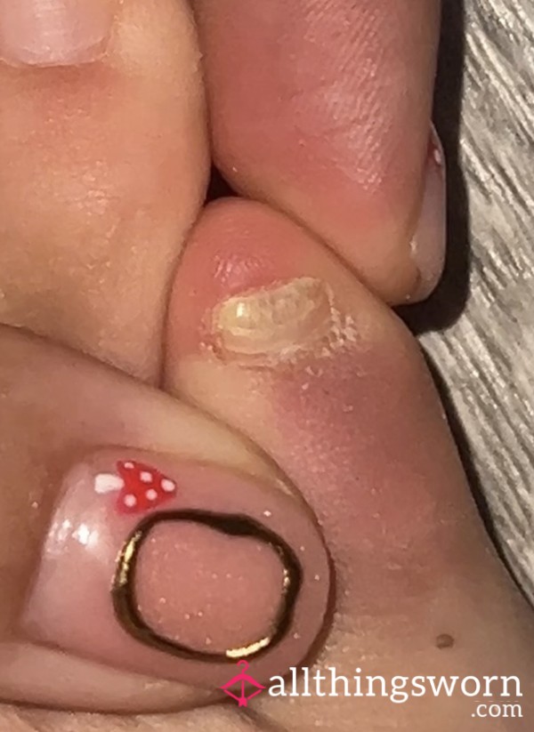 Watch Me P**l My Baby Toe Nail Off
