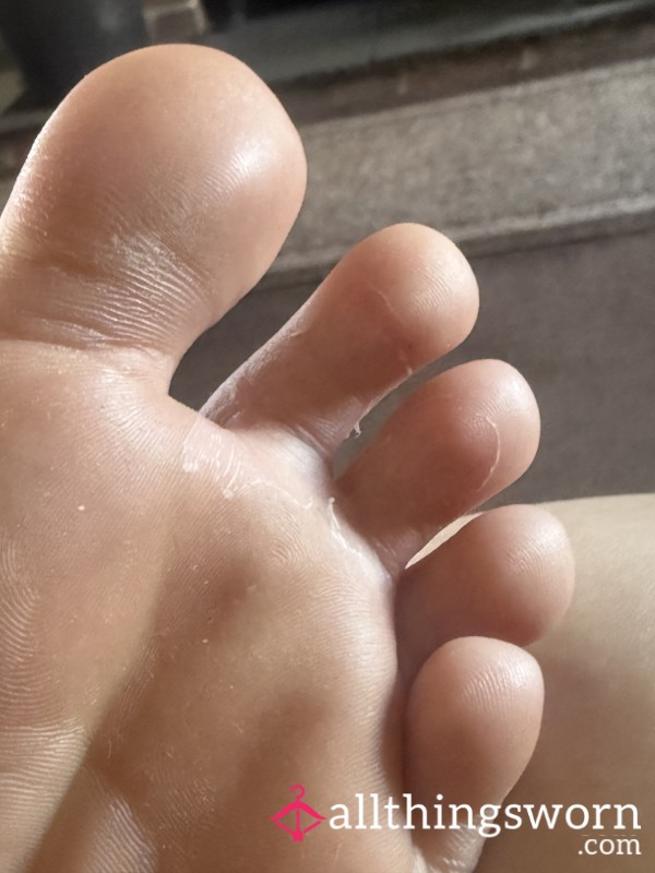 Watch My Dead Skin P**l