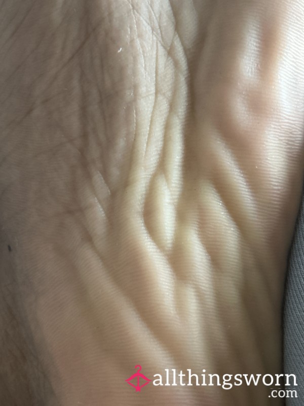 Wrinkly Feet