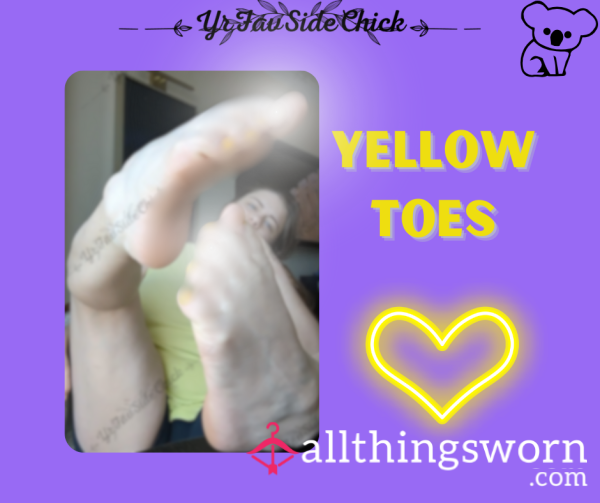 Yellow Toes (10 Photos)