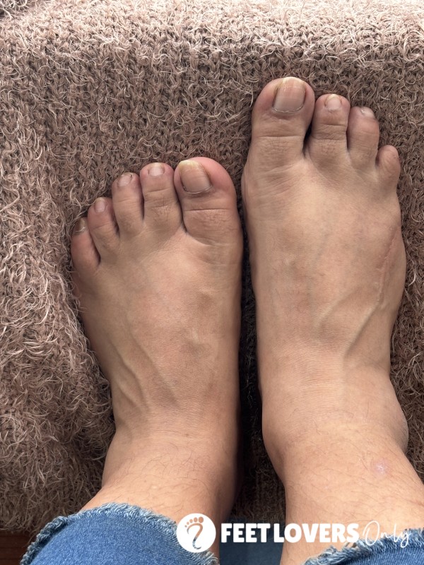 Amputatedfeet
