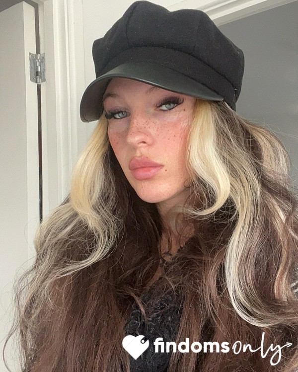 Callmefreckles