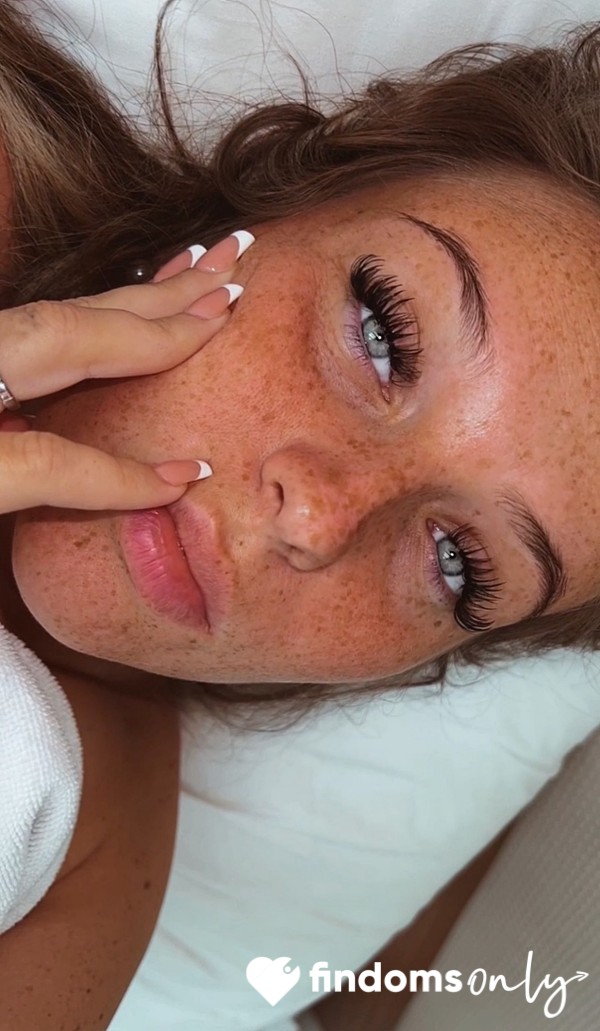 Callmefreckles