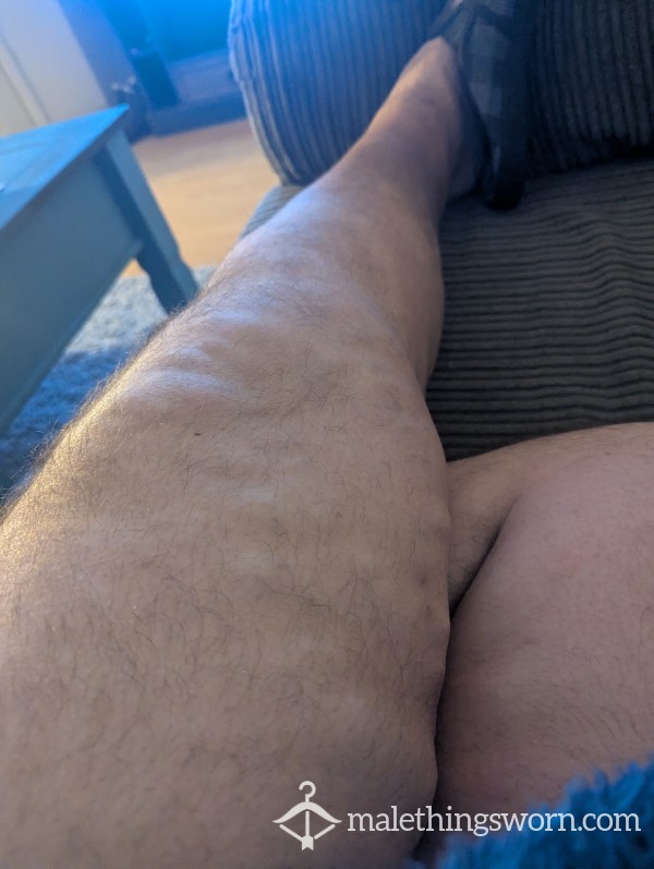 Lumpyleftleg41