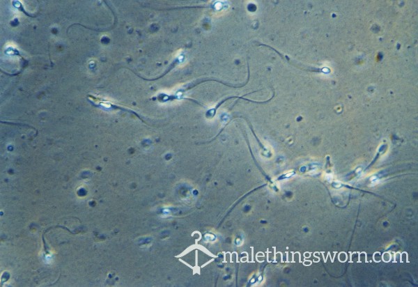 Tadpoles