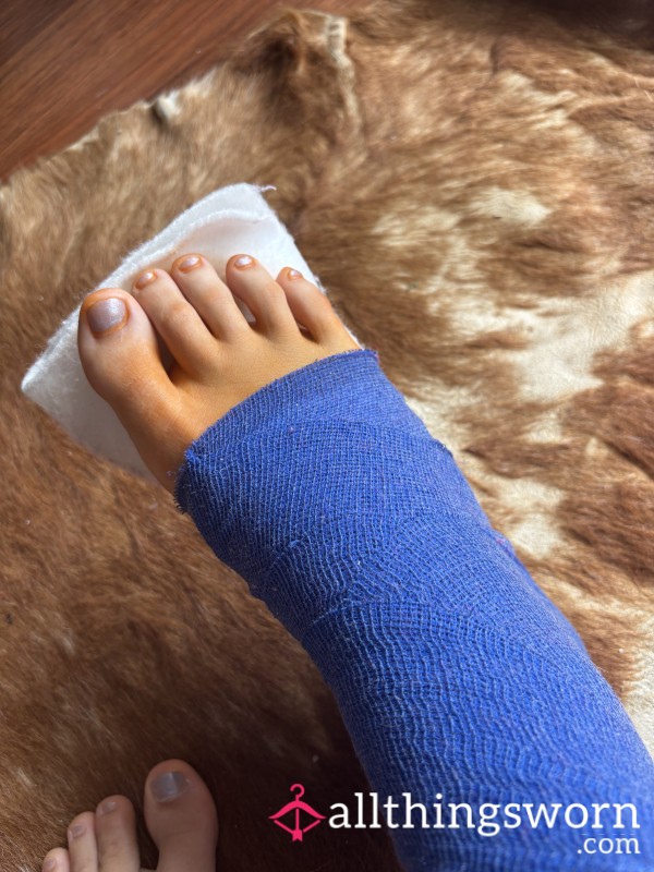 Toes_4_trouble