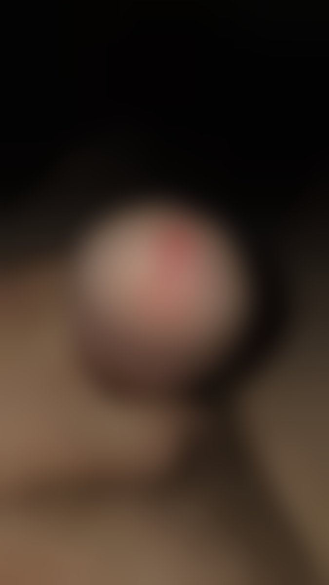 Content preview
